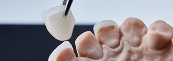 Tweezers placing a veneer over a model of a tooth